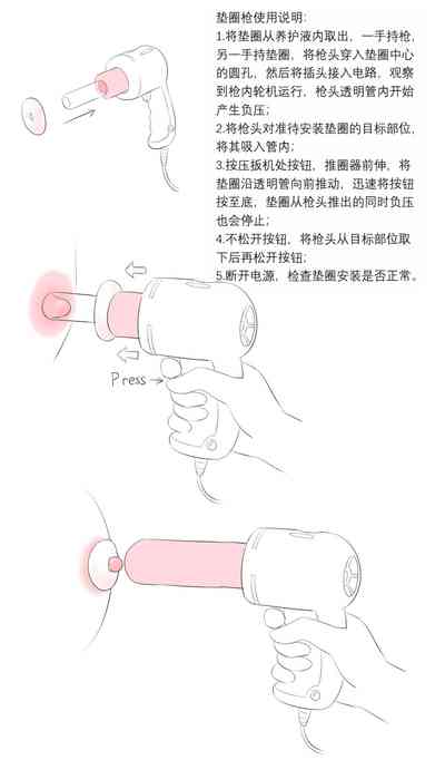 第393页图